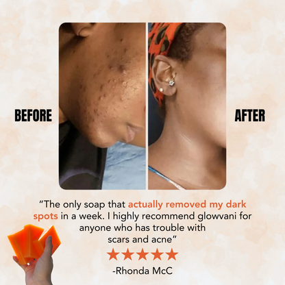 Turmeric Brightening Soap