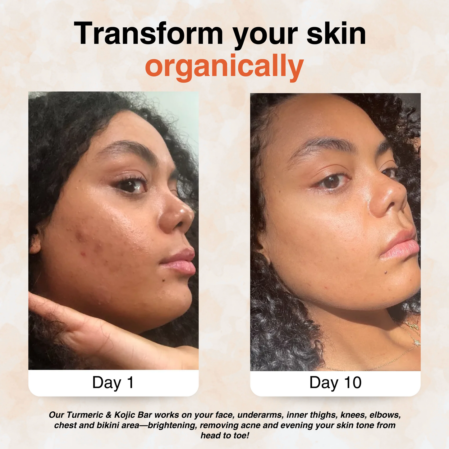 Turmeric Brightening Soap