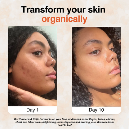 Turmeric Brightening Soap