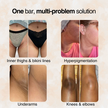 Turmeric Brightening Soap