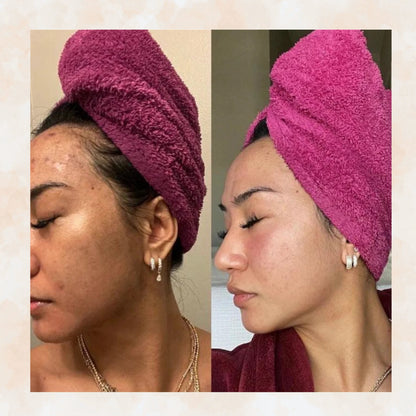 Turmeric Brightening Soap